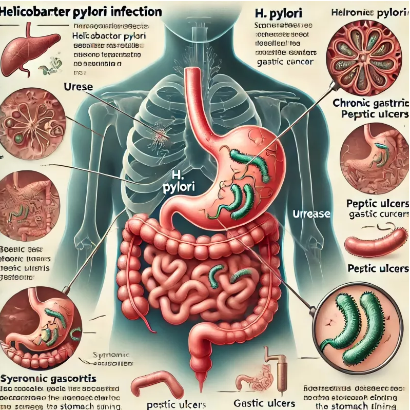 H.-Pylori-Tests leicht gemacht: Ihre Lösung für eine schnelle und zuverlässige Diagnose